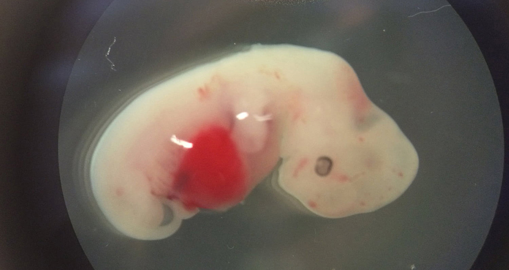 هیبرید انسان و حیوان